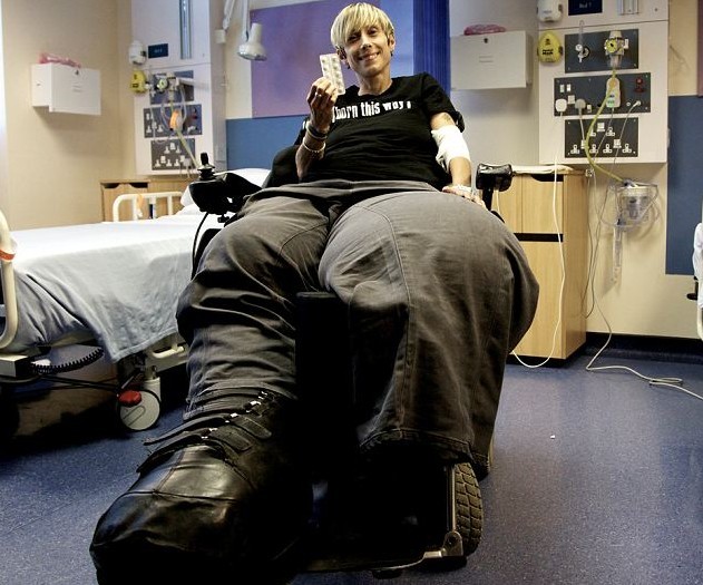 英女子患罕見疾病雙腿重200斤 基因療法有望助其再次走路