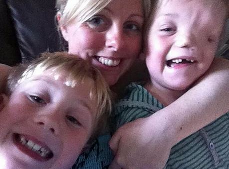 英國男童天生“半臉” 同胞兄弟情令人動(dòng)容