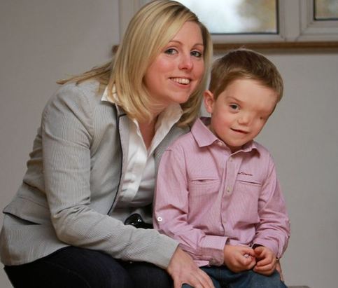 英國(guó)男童天生“半臉” 同胞兄弟情令人動(dòng)容