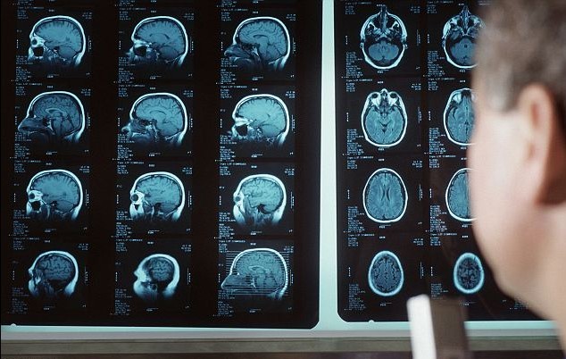 美政府擬繪制人腦活動圖 十年或耗資數(shù)十億美元