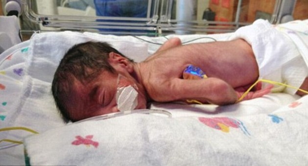 美國母親情人節(jié)生出兩組同卵雙胞胎 自然受孕率僅7000萬分之一