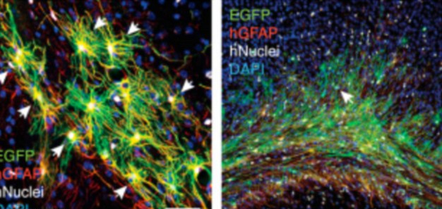 美培育“人腦老鼠” 或可啟發(fā)神經(jīng)疾病新療法