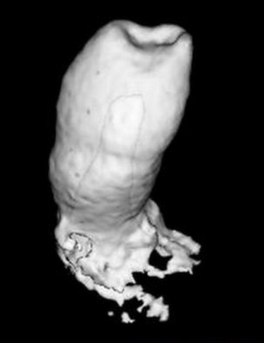 英科學(xué)家用牙齦細(xì)胞培育出新牙 擺脫假牙有希望