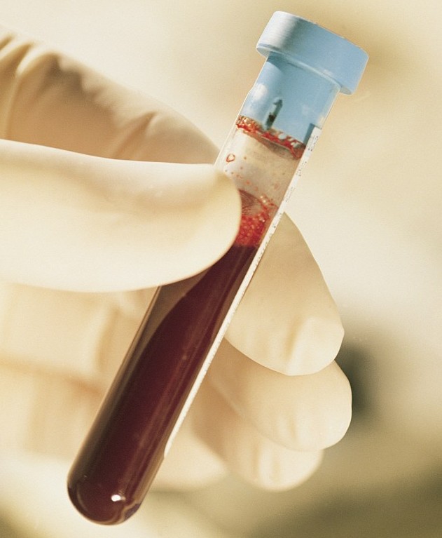 挪威一幼兒園教師好怪異 讓學(xué)生舔嘗血液被解雇