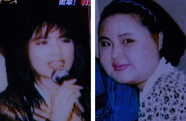 韓模特整容成癮 自行注射食用油成“站著的風扇”