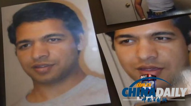 紐約帥哥歷經(jīng)22次整形手術 鼻子感染被割掉生不如死