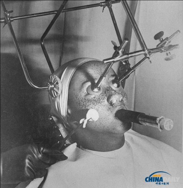 加熱美膚帽、冰凍祛斑機(jī) 圖說上世紀(jì)“恐怖”美容法