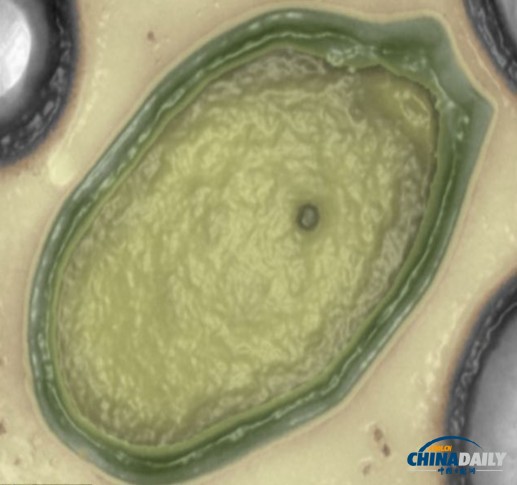 法國科學(xué)家發(fā)現(xiàn)前所未見的巨型病毒 或來自火星