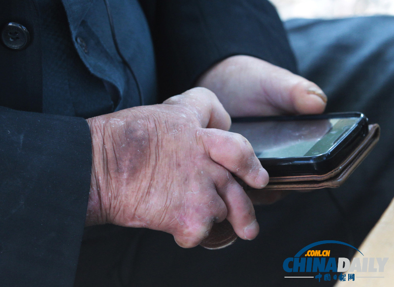 歷史遺留之痛:走近韓國小鹿島麻風(fēng)病院