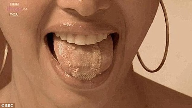 探訪委內(nèi)瑞拉世界小姐訓練營:為減肥舌上縫塑料網(wǎng)(組圖)