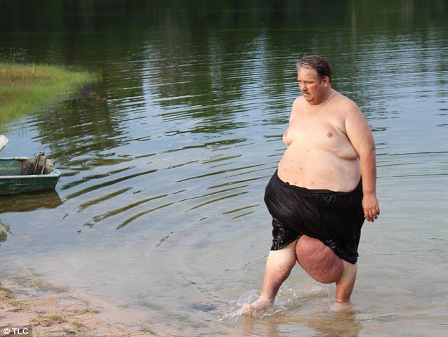 妻遭謀殺 美國男子患暴食癥體重暴漲到318公斤