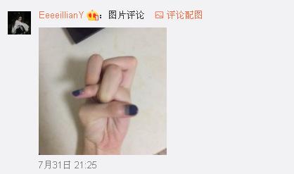 一般人做不出的張一山秋水誓？醫(yī)生：這是??！